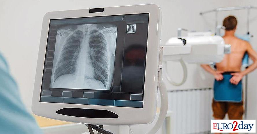 Πώς-μπορούν-να-μειωθούν-οι-βλάβες-που-προκαλεί-το-κάπνισμα