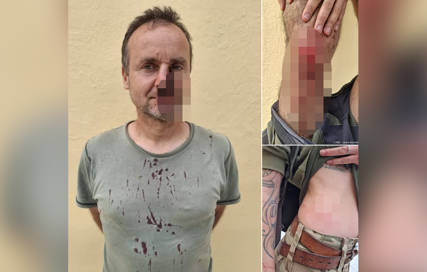 Άγριο-ξύλο-στη-Ζάκυνθο-–-Λαθροκυνηγοί-έστειλαν-στο-νοσοκομείο-ορνιθολόγους