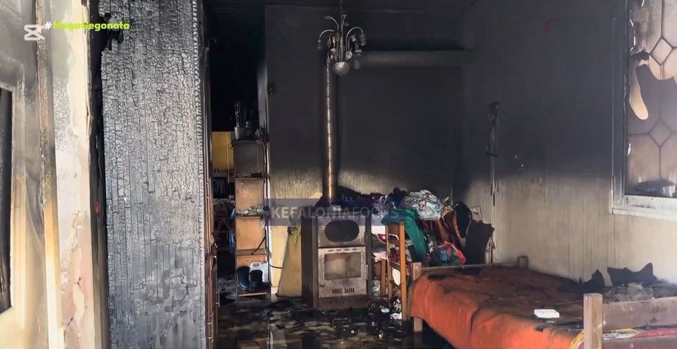 Αισιοδοξία-για-το-3χρονο-αγοράκι-με-εγκαύματα-στους-πνεύμονες-μετά-τη-φωτιά-στο-σπίτι-του:-«Φαίνεται-να-κερδίζει-τη-μάχη»