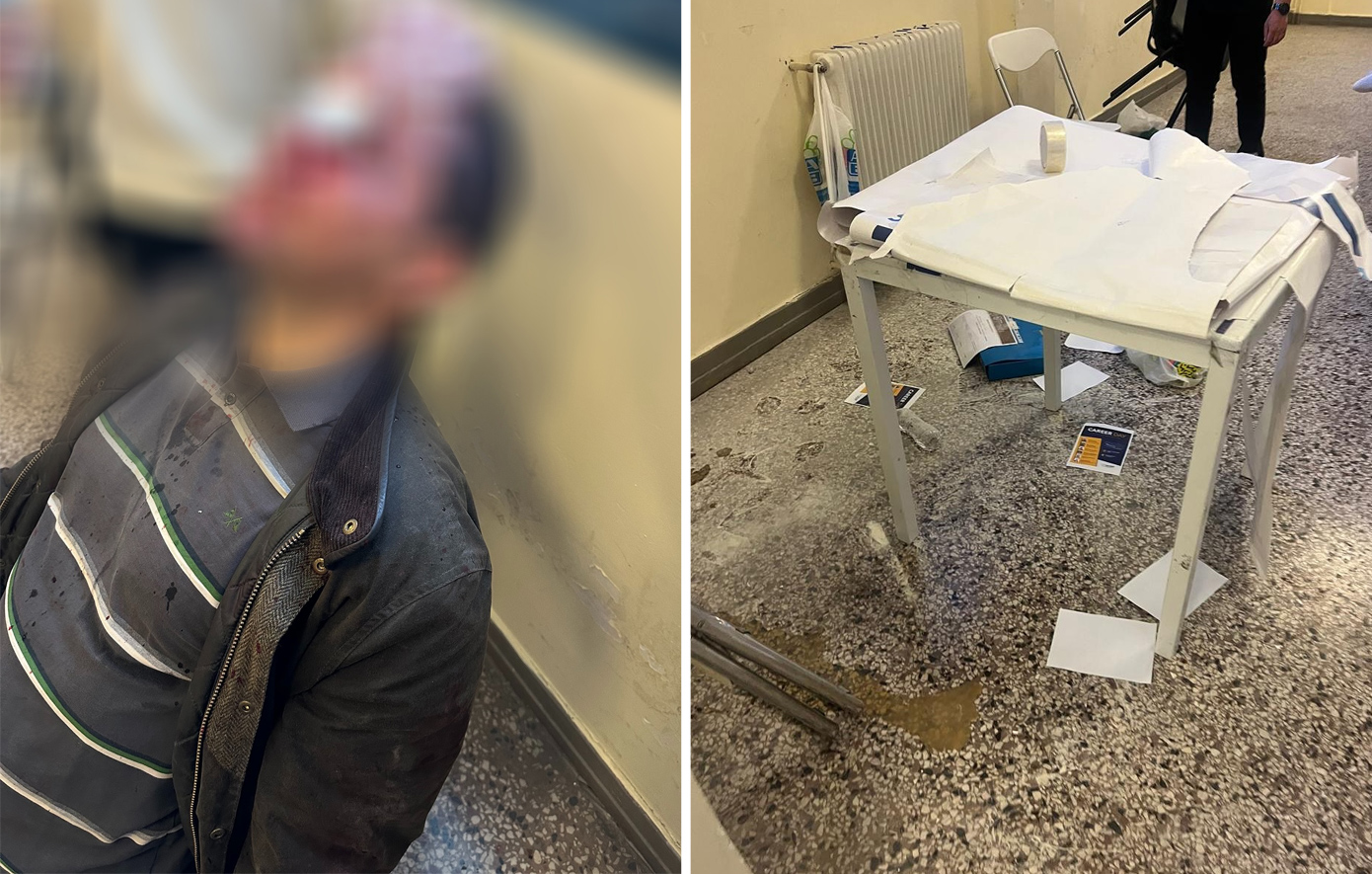 «Το-ότι-ζει-το-παιδί-είναι-θαύμα»-–-Μαρτυρίες-και-φωτογραφίες-από-την-άγρια-επίθεση-κουκουλοφόρων-στη-Νομική-Αθηνών