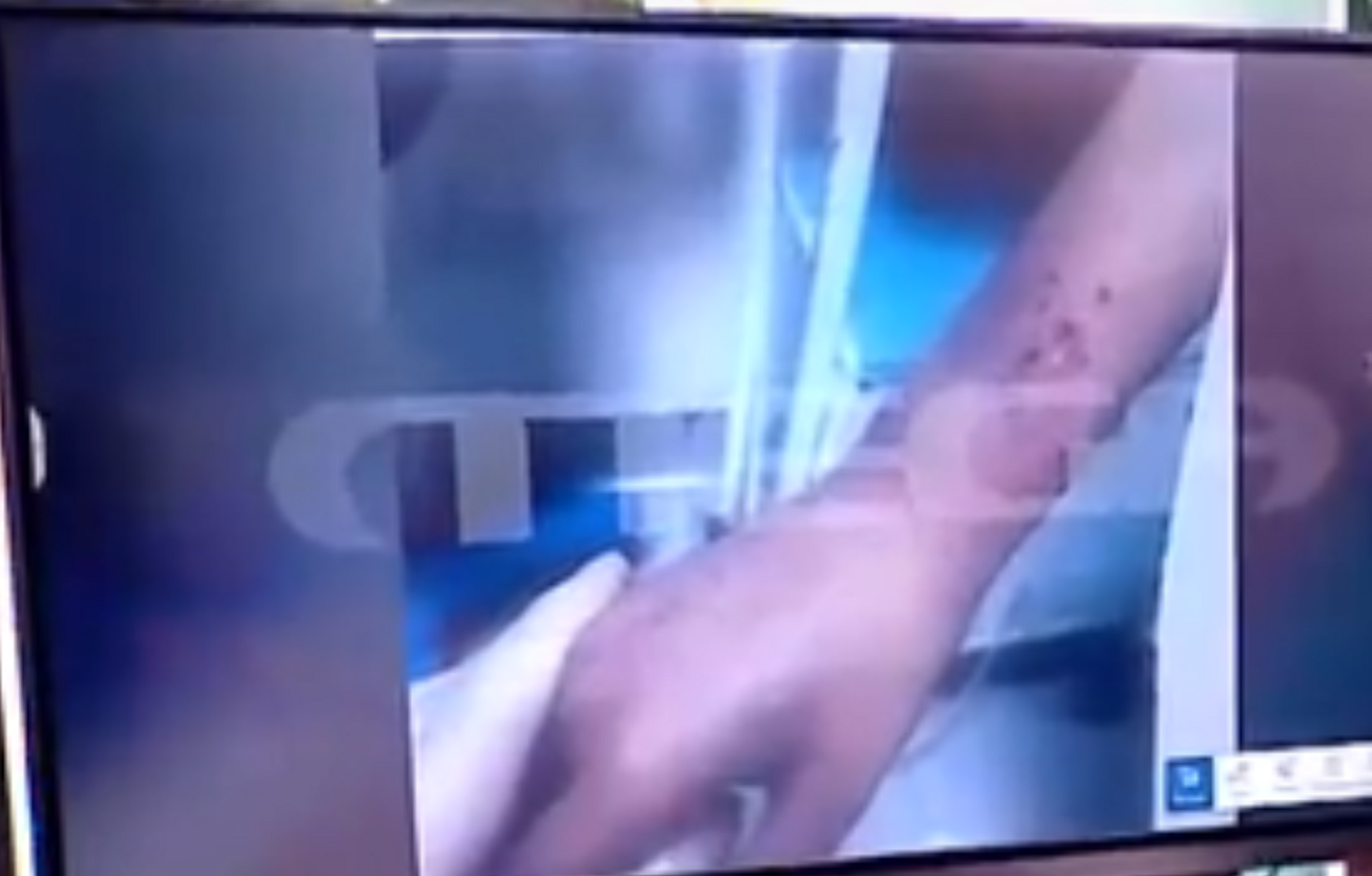 Ανατριχιαστικές-εικόνες-με-τα-αδερφάκια-στη-Λάρισα:-Αυτές-τις-πληγές-είδαν-οι-γιατροί-και-«πάγωσαν»