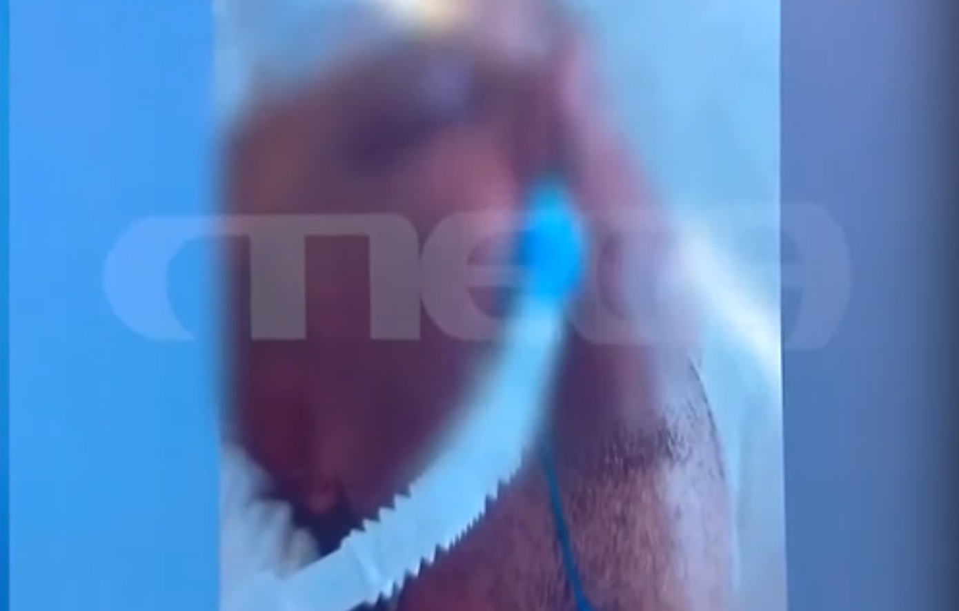 Χαροπαλεύει-ο-50χρονος-στα-Γλυκά-Νερά:-«Μια-γροθιά-ήταν,-αμυχή-προκάλεσε»-–-Κυνικός-ο-δικηγόρος-του-17χρονου