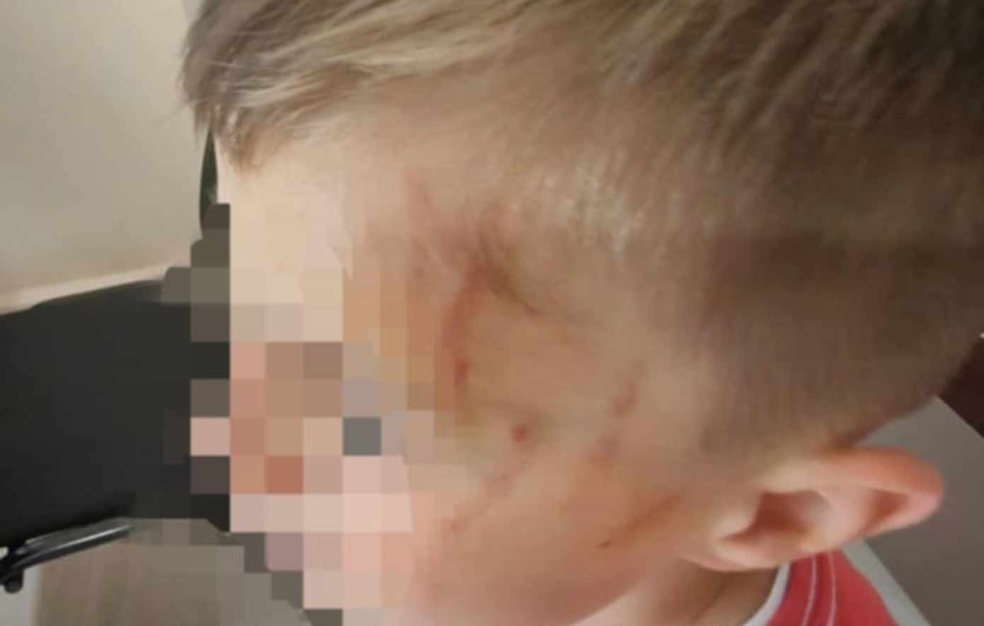 Άγριος-ξυλοδαρμός-5χρονου-στο-Αγρίνιο-από-συμμαθητές-του-–-«Του-είχαν-ζητήσει-να-βγάλει-τα-ρούχα-του»