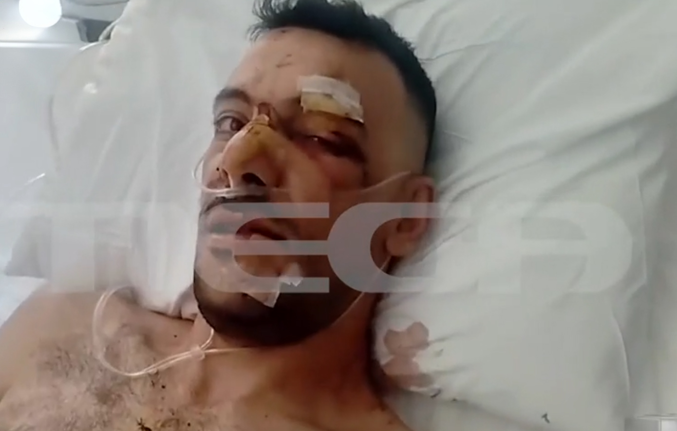 «Έχει-τρύπες-σε-πνεύμονα,-διάφραγμα-και-του-κόπηκαν-οι-μύες»:-Από-θαύμα-ζει-ο-35χρονος-που-δέχθηκε-18-μαχαιριές-σε-πανηγύρι