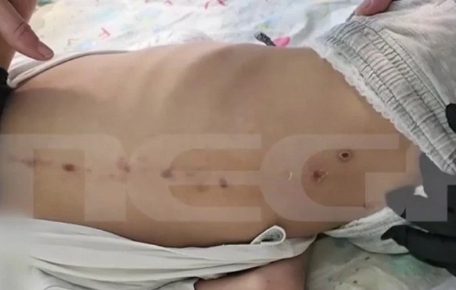 «Προβληματίζουν-τα-σημάδια-που-είναι-συμμετρικά»-–-Τι-λέει-ο-Γρηγόρης-Λέων-για-τα-τραύματα-του-10χρονου-ΑμεΑ-στην-Πάτρα