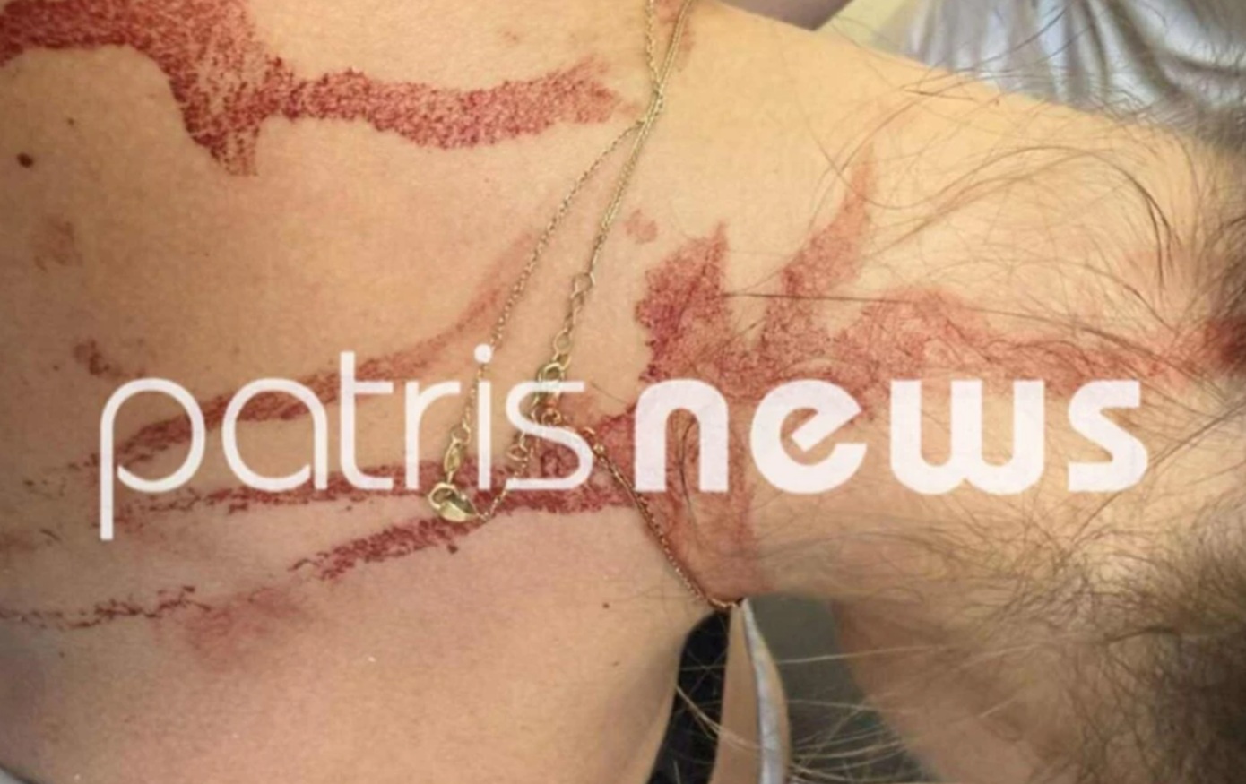 Στη-φυλακή-η-48χρονη-που-κάρφωσε-γυναίκα-με-ψαλίδι-στην-πλάτη