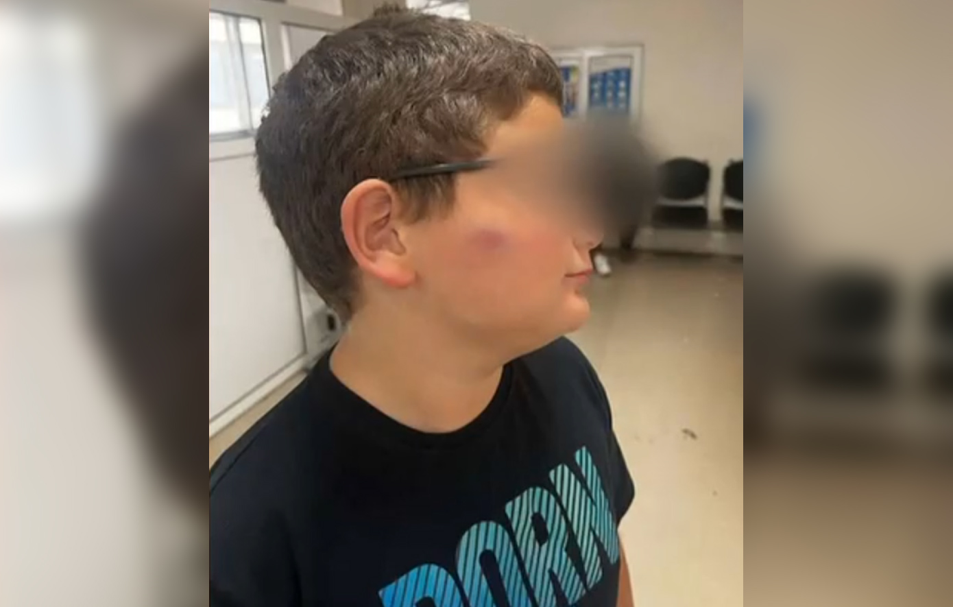 Θύμα-άγριου-bullying-έπεσε-11χρονος-στη-Θεσσαλονίκη-–-Συμμαθητές-του-επιτέθηκαν-στο-προαύλιο-του-σχολείου