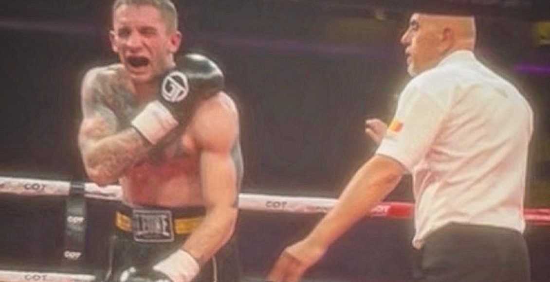 Απίστευτο-περιστατικό-σε-τουρνουά-πυγμαχίας-–-Αθλητής-δάγκωσε-τον-αντίπαλο-του-στη-διάρκεια-του-αγώνα