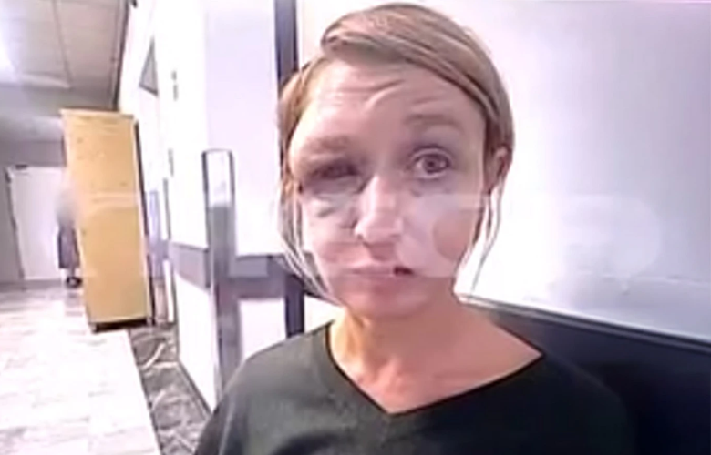 «Τον-αγαπώ»,-σοκάρει-η-εικόνα-και-η-αντίδραση-της-40χρονης-στο-Κορωπί-μετά-τον-ξυλοδαρμό-της