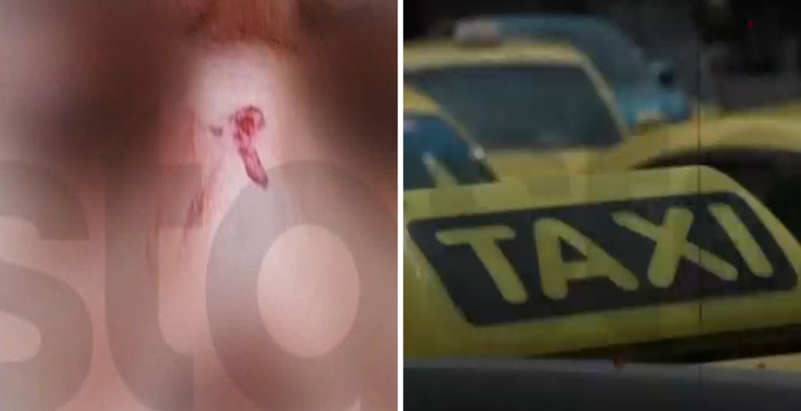 Άγρια-επίθεση-σε-οδηγό-ταξί-στον-Πειραιά-από-επιβάτη-–-«Βροχή»-τα-χτυπήματα-στο-πρόσωπο,-γιατί-δεν-ήταν-ελεύθερος