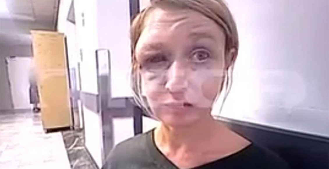 Την-επιμέλεια-των-παιδιών-της-ζητά-η-40χρονη-που-ξυλοκοπήθηκε-από-τον-σύντροφό-της-στο-Κορωπί