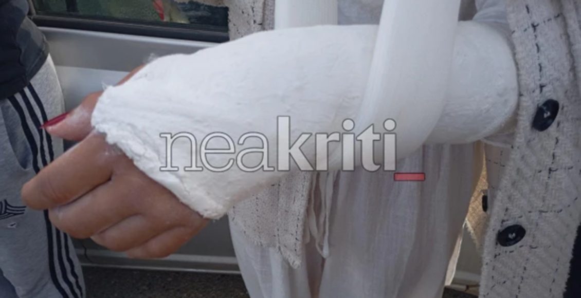 «Αν-χτυπούσε-εμένα,-θα-είχα-σκοτωθεί»:-Συγκλονίζει-η-25χρονη-που-παρασύρθηκε-στην-Κρήτη-–-Νεκρό-το-σκυλάκι-της