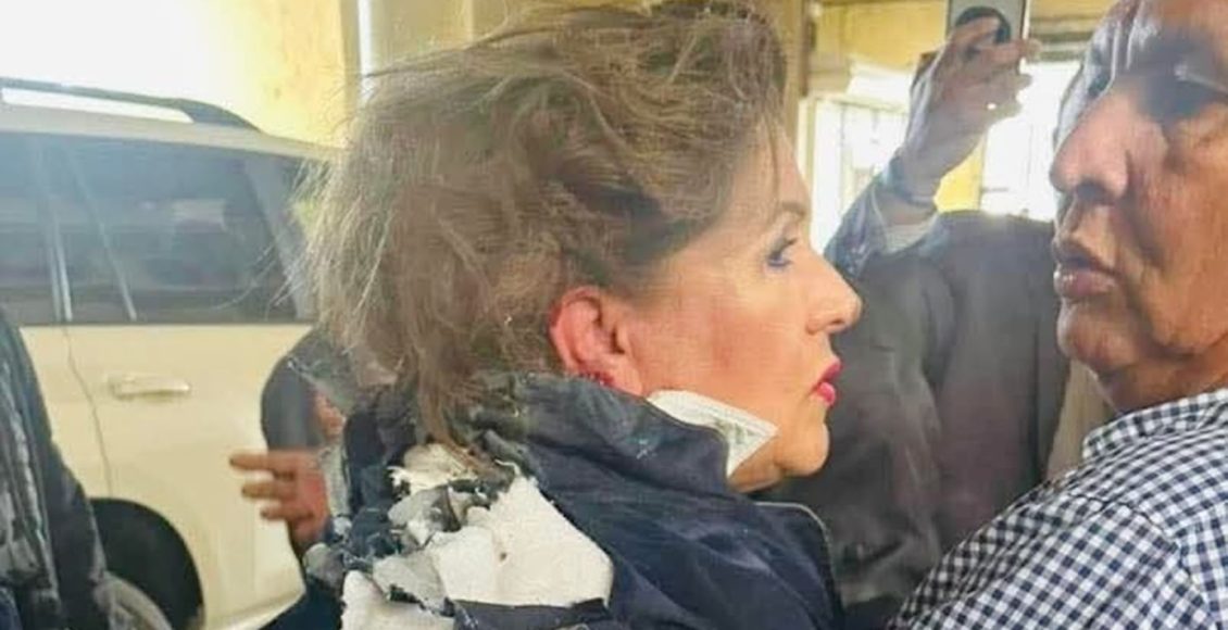 Βουλευτής-τραυματίστηκε-από-εκρηκτικό-μηχανισμό-έξω-από-το-Κογκρέσο-της-Ονδούρας