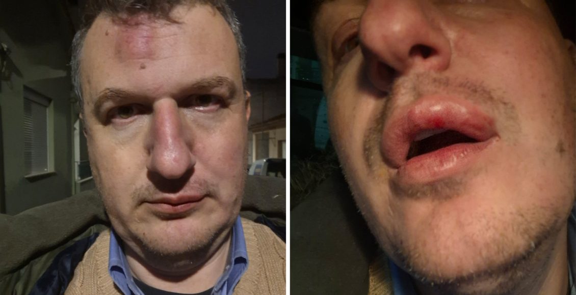 Βροχή-τα-σχόλια-στα-social-media-μετά-την-άγρια-επίθεση-στον-εκδότη-της-«Μαγνησίας»-–-«Συνεχίζω-άτεγκτος»