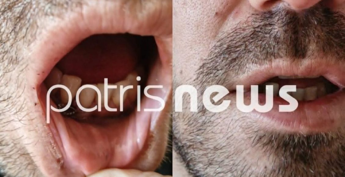 «Με-χτυπούσαν-επί-15-λεπτά»-–-Σοκάρει-η-άγρια-επίθεση-στα-κρατητήρια-της-Αστυνομικής-Διεύθυνσης-Ηλείας