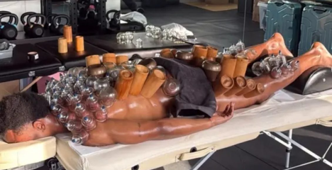 Γιουβέντους:-Ο-Οπέντα-δοκιμάζει-τα-πάντα-για-να-βρει-το-γκολ-–-Ακόμη-και-τη-«θεραπεία-με-βεντούζες»